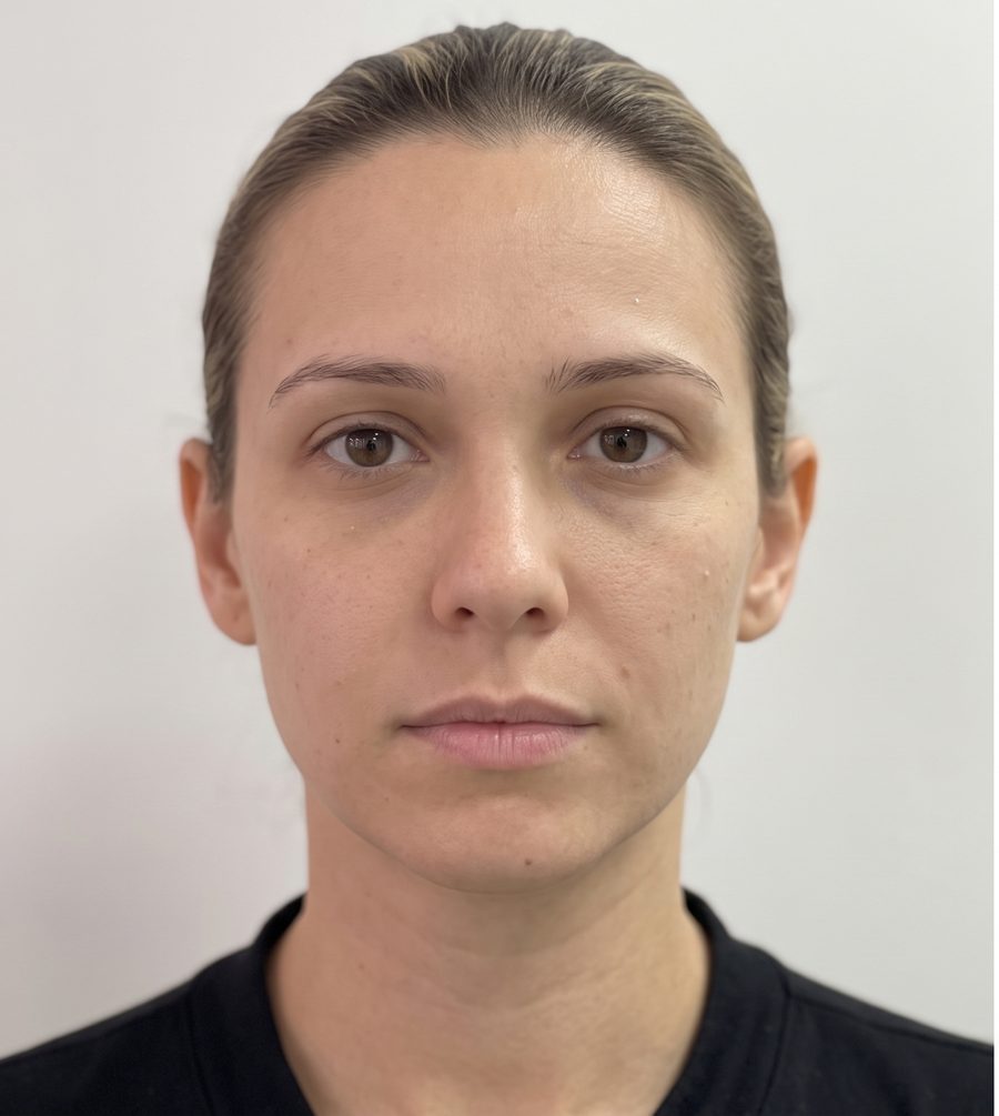 Paciente fictícia (imagem gerada por IA) antes do procedimento labial, rosto frontal inteiro